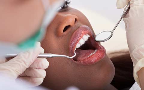 Teeth whitening treatment 